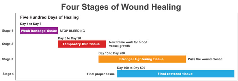 A Diagram of the Four Stages of Healing Over Time