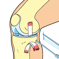 Surgery