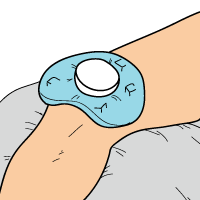 Treatment