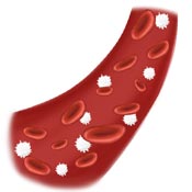 LCL Tear Treatment - Blood Flow